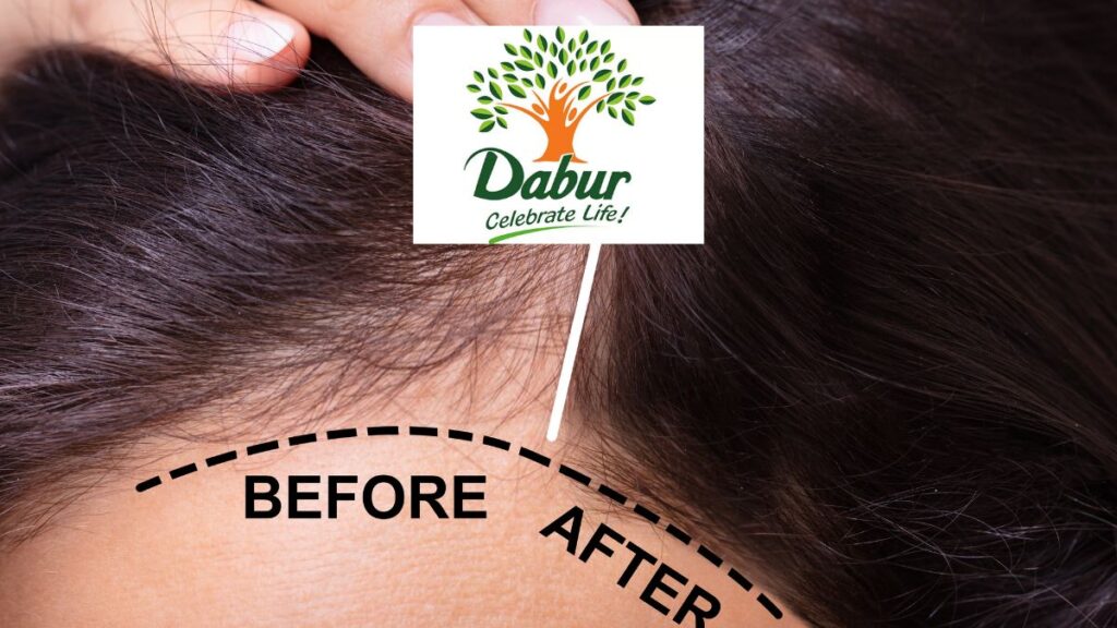 Dabur India